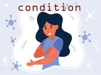 Definition & pronunciation of condition