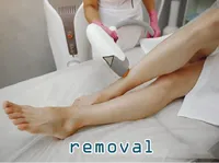Definition & pronunciation of removal