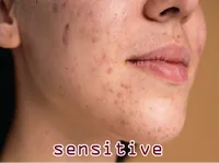 Definition & pronunciation of sensitive
