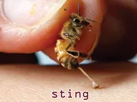Definition & pronunciation of sting
